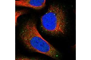 Immunofluorescent staining of human cell line U-2 OS with TRIM7 polyclonal antibody  at 1-4 ug/mL dilution shows positivity in nucleus but not nucleoli, cytoplasm and vesicles. (TRIM7 antibody)