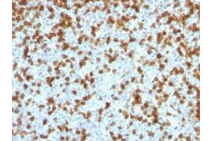Immunohistochemical staining (Formalin-fixed paraffin-embedded sections) of human tonsil with PDCD1 recombinant monoclonal antibody, clone PDCD1/1410R . (Recombinant PD-1 antibody)