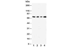 Western blot testing with MEKK3 antibody (MAP3K3 antibody  (N-Term))