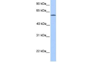 WB Suggested Anti-ACSBG2 Antibody Titration: 0.