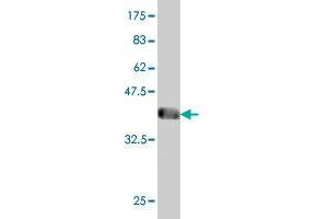 Western Blot detection against Immunogen (43. (NUDT10 antibody  (AA 1-164))