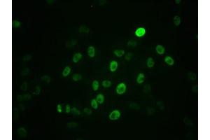 Immunofluorescence staining of Hela cells with ABIN7127717 at 1:100,counter-stained with DAPI. (Recombinant c-MYC antibody  (pSer62))