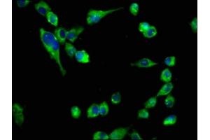 Immunofluorescence staining of SH-SY5Y cells with ABIN7161352 at 1:133, counter-stained with DAPI. (CHRNB2 antibody  (AA 322-458))