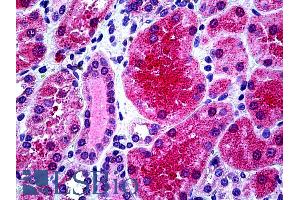 ABIN6391378 (3. (KCNN4 antibody  (Internal Region))