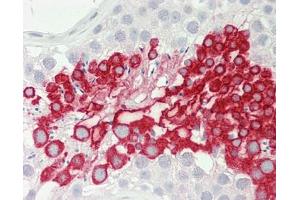 Human Testis: Formalin-Fixed, Paraffin-Embedded (FFPE). (COPS6 antibody  (AA 201-250))