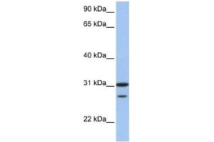 WB Suggested Anti-UBE2C Antibody Titration:  0. (UBE2C antibody  (N-Term))