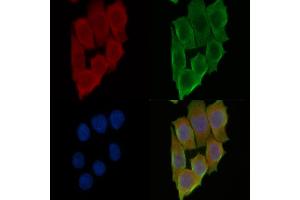 ABIN7095059 and ABIN7099115 staining Hela cells(45 min of heat-shock treatment) by IF/ICC.