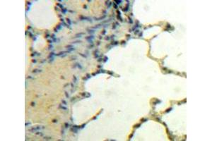Used in DAB staining on fromalin fixed paraffin-embedded Lung tissue (BDNF antibody  (AA 139-249))