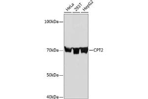 Western blot analysis of extracts of various cell lines, using CPT2 Rabbit mAb (ABIN7266090) at 1:1000 dilution. (CPT2 antibody)