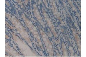 IHC-P analysis of Mouse Intestine Tissue, with DAB staining. (COMP antibody  (AA 554-753))