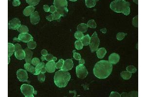 Immunocytochemistry detection of HSV by monoclonal antibody T111 in infected cells. (HSV-1+2 gB antibody)