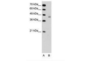 Image no. 1 for anti-DEAH (Asp-Glu-Ala-His) Box Polypeptide 30 (DHX30) (AA 51-100) antibody (ABIN6736327)