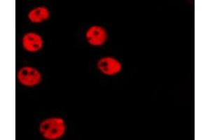 ABIN6266522 staining HepG2 by IF/ICC. (Cyclin A antibody)