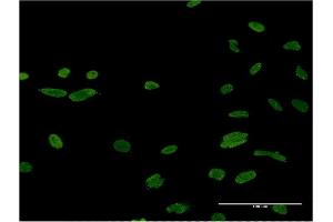Immunofluorescence of monoclonal antibody to ASF1B on HeLa cell. (ASF1B antibody  (AA 1-202))