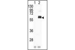 Western blot analysis of CDKL2 (arrow) using CDKL2 antibody (Center) Cat. (CDKL2 antibody  (AA 233-263))