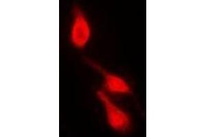 Immunofluorescent analysis of p38 (pY182) staining in HepG2 cells. (MAPK14 antibody  (pTyr182))