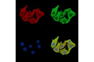 ABIN7097126 and ABIN7101194 staining Hela cells by IF/ICC.