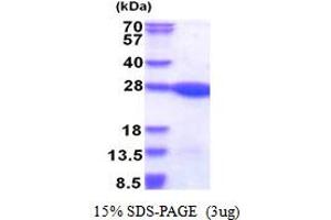 Leucine Zipper and CTNNBIP1 Domain Containing (LZIC) (AA 1-190) protein (His tag)