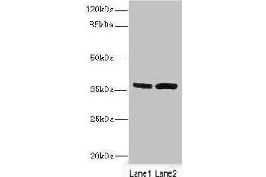 Western blot All lanes: C1GALT1C1 antibody at 3. (C1GALT1C1 antibody  (AA 30-190))