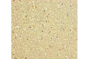 Immunohistochemistry of paraffin-embedded human brain tissue using ABIN7150811 at dilution of 1:100 (DCTN3 antibody  (AA 2-176))