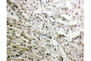 IHC-P: GR antibody testing of rat heart tissue (GR (AA 20-199) antibody)