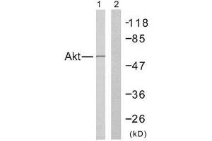 Western blot analysis of the extracts from Jurkat cells using Akt (Ab-308) antibody (E021055). (AKT1 antibody)