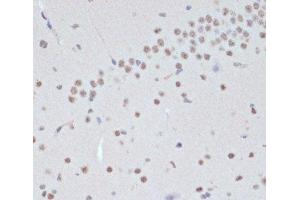 Immunohistochemistry of paraffin-embedded Mouse brain using Phospho-Jak2(Y1007/1008) Polyclonal Antibody at dilution of 1:200 (40x lens). (JAK2 antibody  (pTyr1007, pTyr1008))