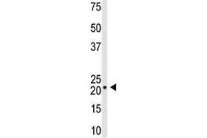 Image no. 1 for anti-Visinin-Like 1 (VSNL1) (C-Term) antibody (ABIN357108) (VSNL1 antibody  (C-Term))