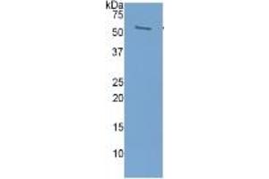 WB of Protein Standard: different control antibodies  against Highly purified E. (Prolactin ELISA Kit)
