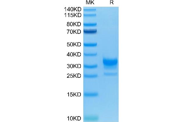 FCGR2B Protein (AA 46-217) (His-Avi Tag)