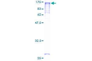 Image no. 1 for N-Acetyltransferase 10 (GCN5-Related) (NAT10) (AA 1-1025) protein (GST tag) (ABIN1312001) (NAT10 Protein (AA 1-1025) (GST tag))