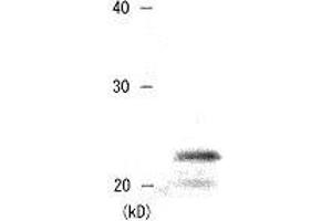 Western Blotting (WB) image for anti-Chromobox Homolog 5 (CBX5) (AA 179-191) antibody (ABIN2452033) (CBX5 antibody  (AA 179-191))