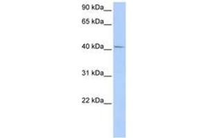 Image no. 1 for anti-General Transcription Factor IIH, Polypeptide 4, 52kDa (GTF2H4) (AA 72-121) antibody (ABIN6742235) (GTF2H4 antibody  (AA 72-121))