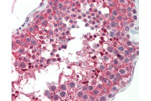 Anti-CNOT3 antibody IHC staining of human testis.