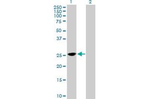Western Blot analysis of TPD52 expression in transfected 293T cell line by TPD52 MaxPab polyclonal antibody. (TPD52 antibody  (AA 1-184))