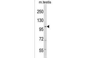 RANBP17 Antibody (N-term) (ABIN1539077 and ABIN2849983) western blot analysis in mouse testis tissue lysates (35 μg/lane). (RANBP17 antibody  (N-Term))