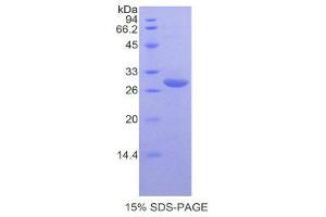 SDS-PAGE (SDS) image for Complement Decay-Accelerating Factor (CD55) (AA 47-286) protein (His tag) (ABIN2120946) (CD55 Protein (AA 47-286) (His tag))