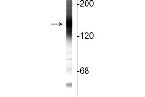 Western blot of rat cortical lysate showing specific immunolabeling of the ~160 kDa adenylate cyclase III protein. (ADCY3 antibody  (C-Term))
