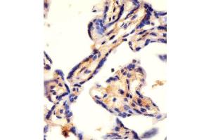 Immunohistochemistry (Paraffin-embedded Sections) (IHC (p)) image for anti-Carbamoyl-Phosphate Synthetase 2, Aspartate Transcarbamylase, and Dihydroorotase (CAD) (AA 780-809) antibody (ABIN655062)
