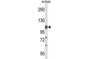 Western Blotting (WB) image for anti-Glycine Dehydrogenase (GLDC) antibody (ABIN3004204) (GLDC antibody)