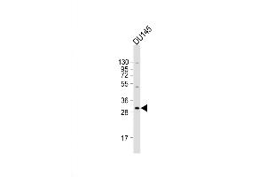 Western Blot at 1:2000 dilution + DU145 whole cell lysate Lysates/proteins at 20 ug per lane. (BASP1 antibody  (AA 123-150))