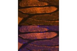Immunofluorescence analysis of mouse skeletal muscle using α-Actin-1  Rabbit mAb (ABIN1682816, ABIN7101454, ABIN7101455 and ABIN7101456) at dilution of 1:100 (40x lens).