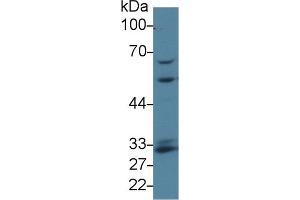 Detection of GCLM in Human K562 cell lysate using Polyclonal Antibody to Glutamate Cysteine Ligase, Modifier Subunit (GCLM)