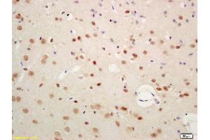 Formalin-fixed and paraffin embedded rat brain labeled with Anti-SIAH1 Polyclonal Antibody, Unconjugated (ABIN701350) at 1:200 followed by conjugation to the secondary antibody and DAB staining (SIAH1 antibody  (AA 201-282))