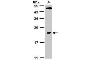 WB Image Sample(30 ug whole cell lysate) A:293T 12% SDS PAGE antibody diluted at 1:500 (TPRKB antibody)
