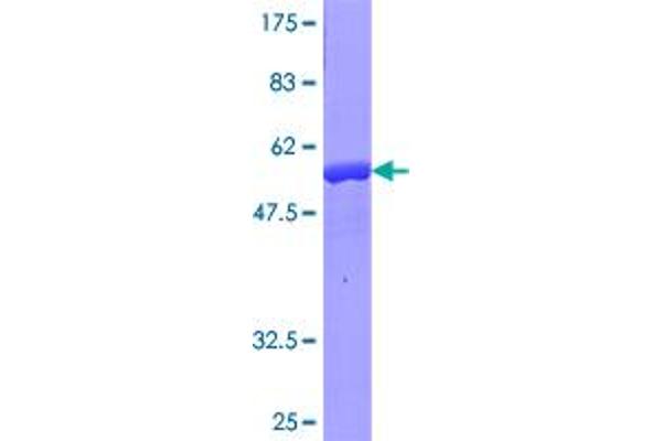 CRYBB1 Protein (AA 1-252) (GST tag)