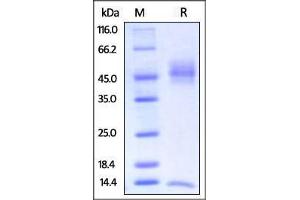 Biotinylated Rat FcRn / FCGRT & B2M on SDS-PAGE under reducing (R) condition.