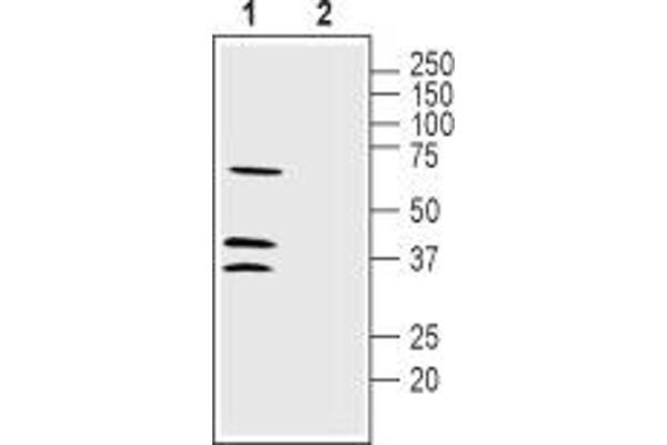 LRRC26 antibody  (C-Term, Intracellular)