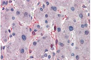 Human Liver: Formalin-Fixed, Paraffin-Embedded (FFPE) (SIAH1 antibody  (AA 191-240))