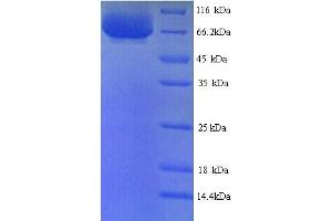 SDS-PAGE (SDS) image for PTK7 Protein tyrosine Kinase 7 (PTK7) (AA 31-704), (Extracellular) protein (His tag) (ABIN5714338)